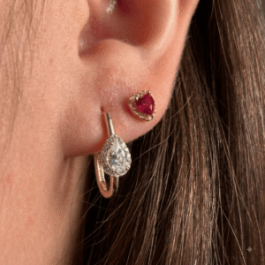 Aretes